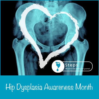 Developmental Dysplasia of the Hip/Hip Dysplasia – what do you know about it?