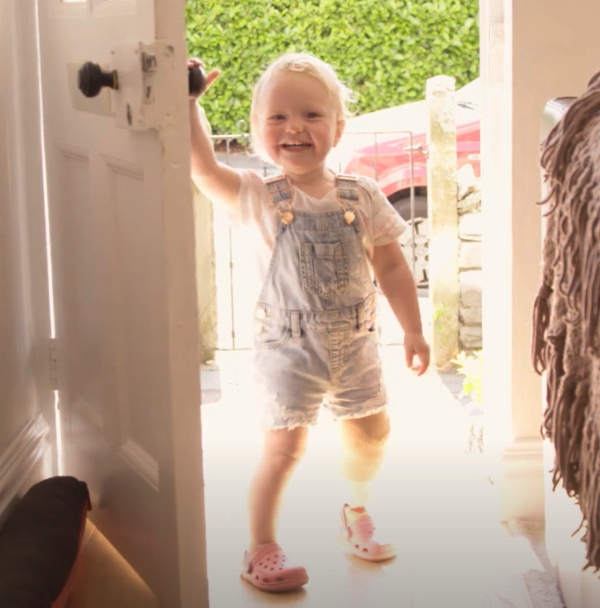 Laila learning to walk with her prosthetic leg