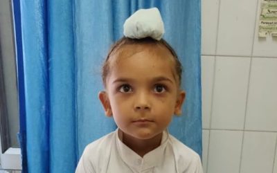 Gurpreet’s clubfoot relapse story (India)