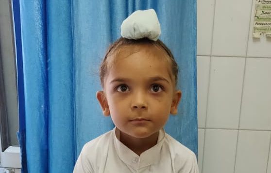 Gurpreet’s clubfoot relapse story (India)