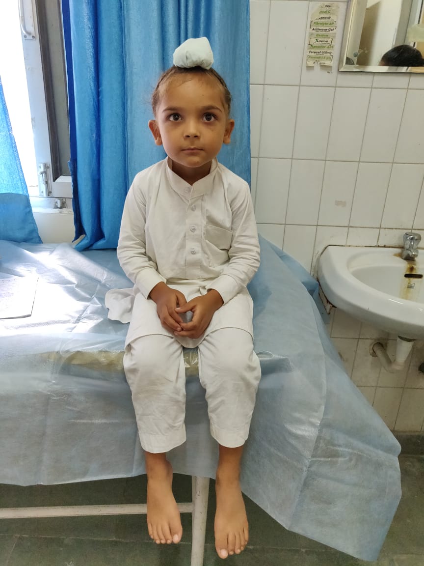 Indian boy Gurpreet undergoing treatment for clubfoot