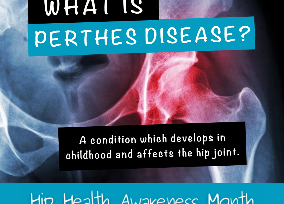 Understanding a painful, little-known condition in children: Perthes disease