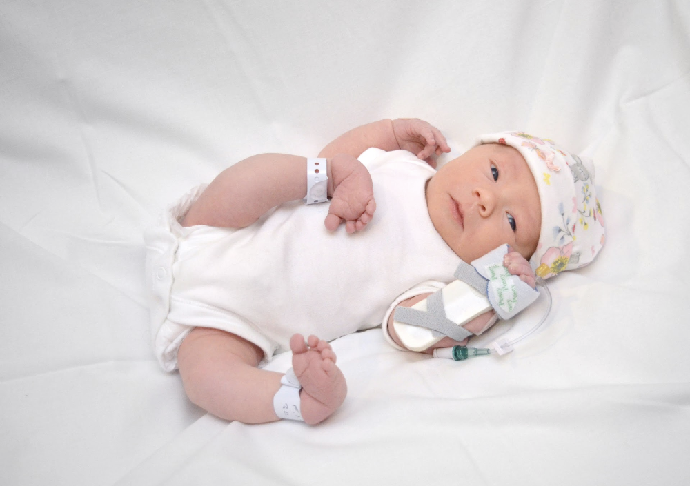 Born with Bilateral Knee Dislocation and Bilateral CTVE STEPS Charity